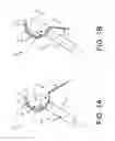 Fig. 02 - Movable curved needle for delivering implants and methods of delivering implants