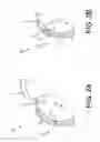 Fig. 04 - Movable curved needle for delivering implants and methods of delivering implants