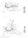 Fig. 06 - Movable curved needle for delivering implants and methods of delivering implants