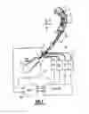 Fig. 02 - Automatic atherectomy system