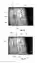 Fig. 06 - Methods and systems for directing movement of a tool in hair transplantation procedures