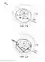 Fig. 03 - Devices, systems and methods for tissue repair