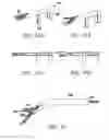 Fig. 33 - Devices, systems and methods for tissue repair