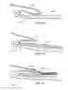 Fig. 07 - Methods and apparatus for transpericardial left atrial appendage closure
