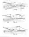 Fig. 09 - Methods and apparatus for transpericardial left atrial appendage closure