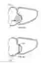 Fig. 11 - Methods and apparatus for transpericardial left atrial appendage closure