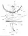 Fig. 04 - ANASTOMOSIS DEVICE AND RELATED METHODS