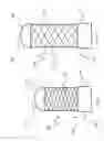 Fig. 05 - ANASTOMOSIS DEVICE AND RELATED METHODS