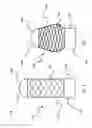 Fig. 06 - ANASTOMOSIS DEVICE AND RELATED METHODS