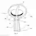 Fig. 07 - ANASTOMOSIS DEVICE AND RELATED METHODS