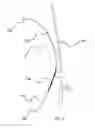 Fig. 08 - ANASTOMOSIS DEVICE AND RELATED METHODS