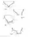 Fig. 04 - GASTROINTESTINAL IMPLANT DEVICE