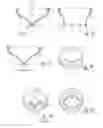Fig. 05 - GASTROINTESTINAL IMPLANT DEVICE
