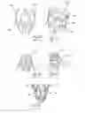 Fig. 09 - GASTROINTESTINAL IMPLANT DEVICE