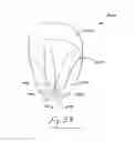 Fig. 19 - GASTROINTESTINAL IMPLANT DEVICE