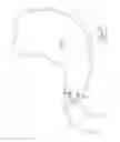 Fig. 24 - GASTROINTESTINAL IMPLANT DEVICE