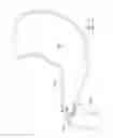 Fig. 26 - GASTROINTESTINAL IMPLANT DEVICE