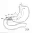 Fig. 35 - GASTROINTESTINAL IMPLANT DEVICE