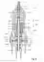 Fig. 05 - Vitrectomy probe with adjustable cutter port size