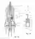 Fig. 07 - Vitrectomy probe with adjustable cutter port size