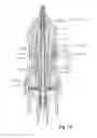 Fig. 11 - Vitrectomy probe with adjustable cutter port size