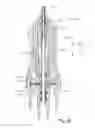 Fig. 12 - Vitrectomy probe with adjustable cutter port size