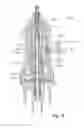 Fig. 11 - Vitrectomy probe with adjustable cutter port size