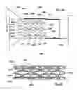 Fig. 05 - Configuration and method for fixation of a filter to a catheter