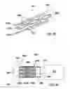 Fig. 06 - Configuration and method for fixation of a filter to a catheter