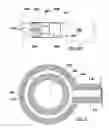 Fig. 07 - Configuration and method for fixation of a filter to a catheter
