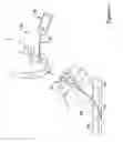 Fig. 02 - Tissue puncture closure device