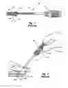 Fig. 02 - Vascular closure device with automatic suture cutter