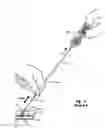 Fig. 04 - Vascular closure device with automatic suture cutter