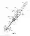 Fig. 11 - Vascular closure device with automatic suture cutter