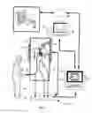 Fig. 02 - BODILY SEALANTS AND METHODS AND APPARATUS FOR IMAGE-GUIDED DELIVERY OF SAME