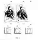 Fig. 09 - BODILY SEALANTS AND METHODS AND APPARATUS FOR IMAGE-GUIDED DELIVERY OF SAME