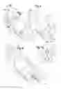 Fig. 04 - Device for mixing and dispensing of two-component reactive surgical sealant