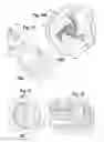 Fig. 05 - Device for mixing and dispensing of two-component reactive surgical sealant