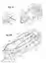 Fig. 07 - Device for mixing and dispensing of two-component reactive surgical sealant