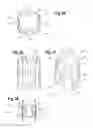 Fig. 10 - Device for mixing and dispensing of two-component reactive surgical sealant