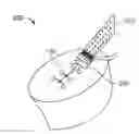 Fig. 01 - SUTURE REPAIRING SYSTEM AND METHOD