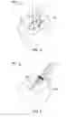 Fig. 04 - SUTURE REPAIRING SYSTEM AND METHOD