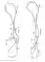 Fig. 06 - RE-TENSIONABLE KNOTLESS SUTURE SYSTEM