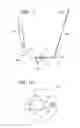 Fig. 02 - Suture anchoring assemblies and methods of use