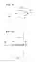 Fig. 05 - Suture anchoring assemblies and methods of use
