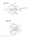Fig. 09 - Suture anchoring assemblies and methods of use