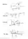 Fig. 13 - Suture anchoring assemblies and methods of use