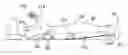 Fig. 01 - Pneumatic joint separator for lower body alignment