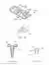 Fig. 05 - Single-lock plating system