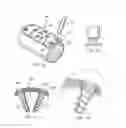 Fig. 14 - Single-lock plating system